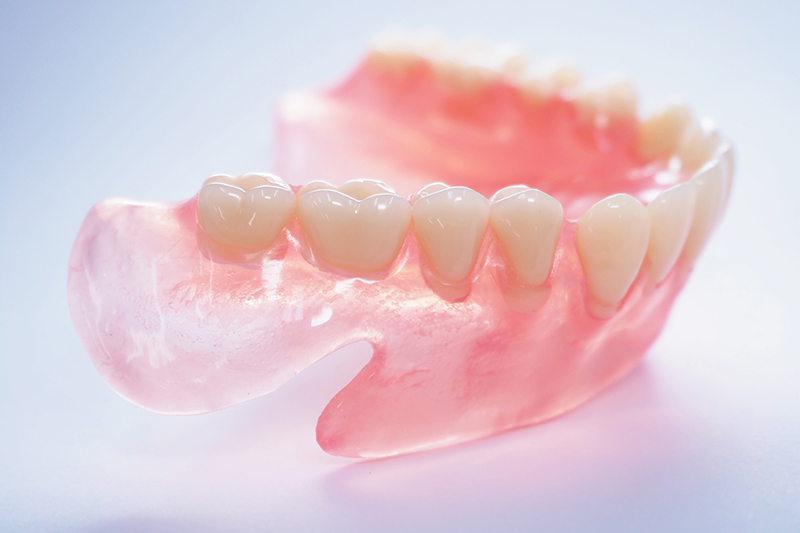 入れ歯/義歯治療